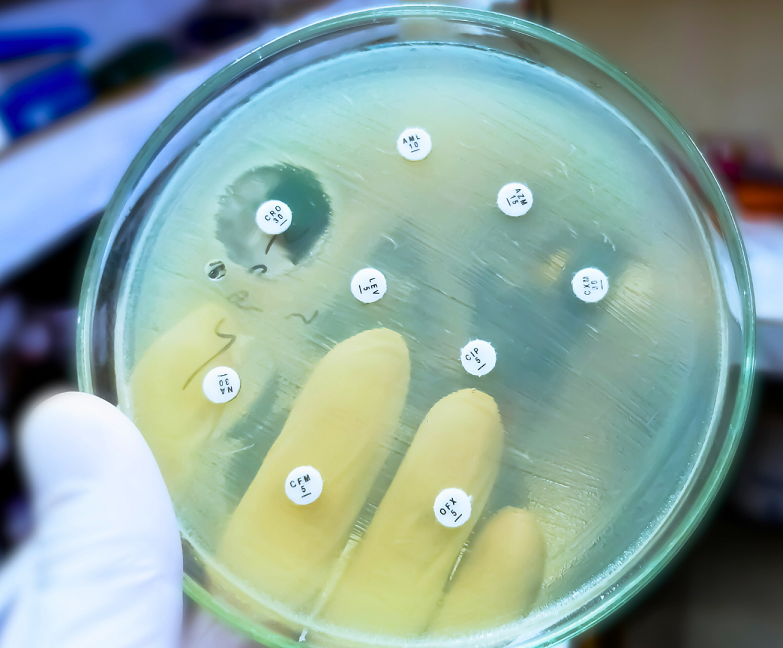 Antibiotic susceptibility test (AST) finds out which antibiotic will be most effective in treating infection. Size of clear zone around the disc shows the sensitivity of antibiotic tested. Lesser the zone, higher is the resistance | Photo: Md Saiful Islam Khan via Getty Images